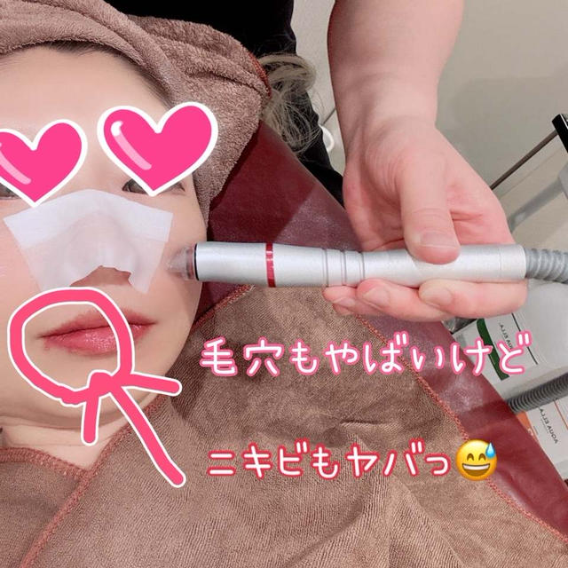 エステで毛穴ケアと化粧品でカバーはどちらがいいのか