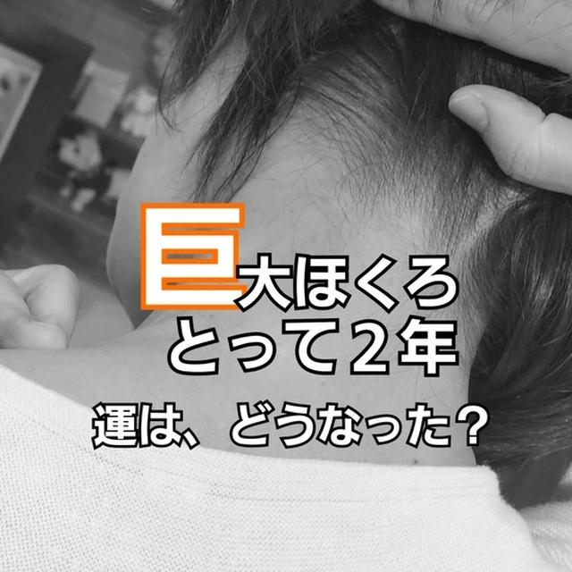【答え合わせ】巨大ほくろを取ったが、運命は変わったのか？