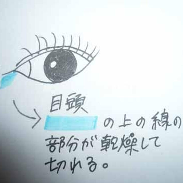 目頭が乾燥すると、切れてしまうのが悩み