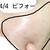 シミ取りレーザー3週間後