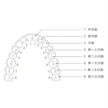 歯科矯正　8回目　前歯4本にゴム