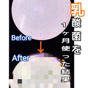 犬の口腔ケアに乳酸菌！わんにゃんぬーるでカンジダ抑制？驚きのビフォーアフター