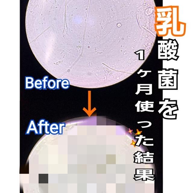 犬の口腔ケアに乳酸菌！わんにゃんぬーるでカンジダ抑制？驚きのビフォーアフター