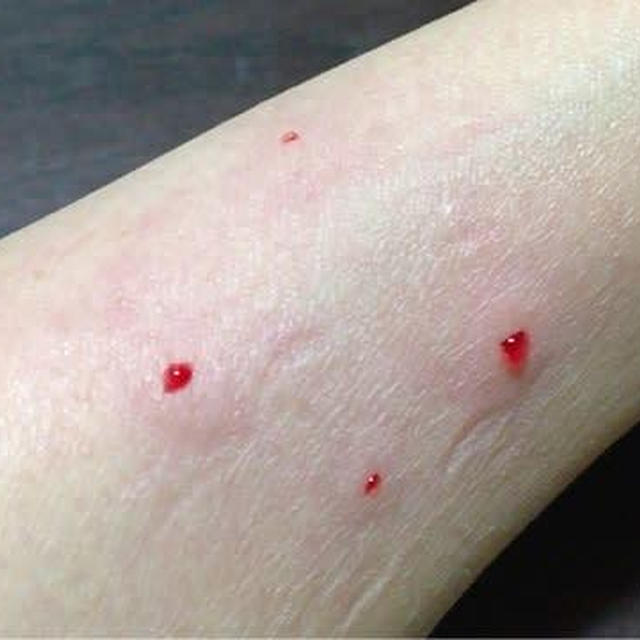 どうせ行くならお早めに〜