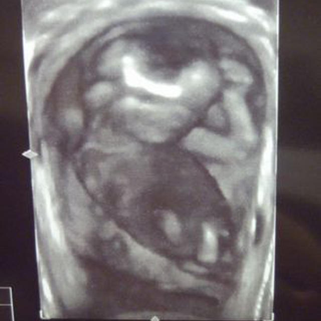 16w1d　妊婦健診（エコー画像有）＆おでかけ