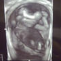16w1d　妊婦健診（エコー画像有）＆おでかけ