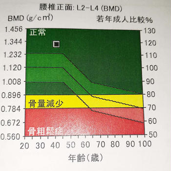 骨密度万歳( ﾉ^ω^)ﾉ