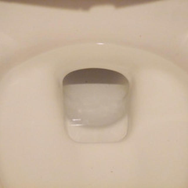 トイレの尿石とりました