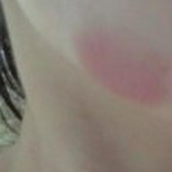 あざがっ