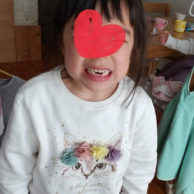 2号さんの下の歯