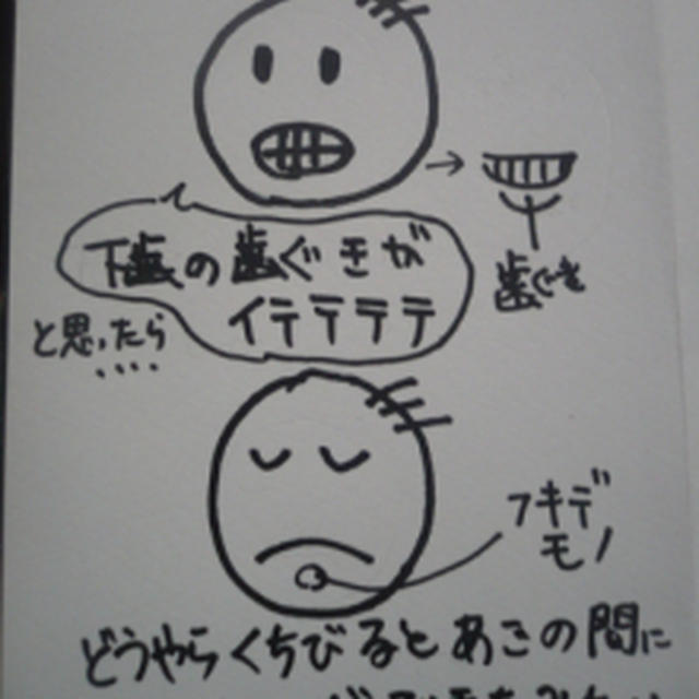 まだらやけとふきでもの