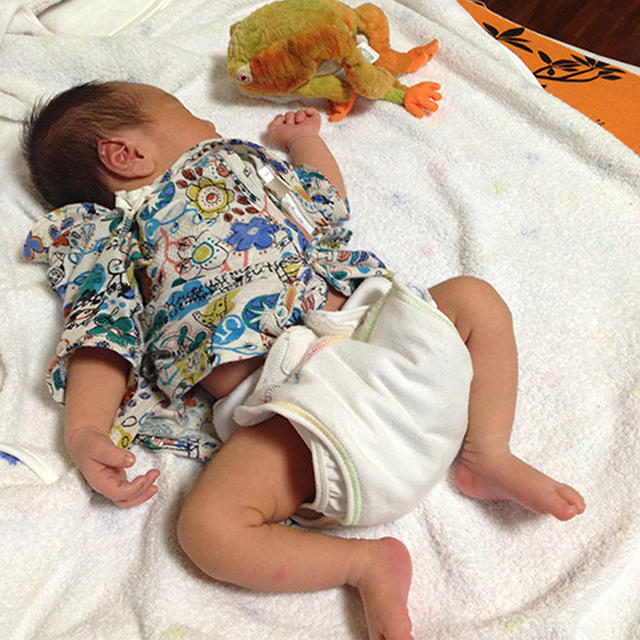 2週間健診