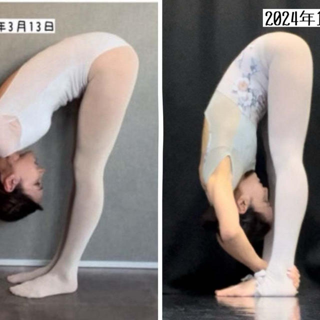 【バレエ】30万かけて整体で柔軟性つけた結果報告