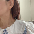 〈美容ネタ〉究極の小顔施術という「インモード」レポ♡