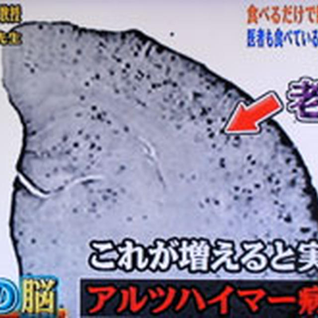 医者も食べている!脳を修復するブレインフーズとは