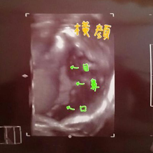 34w6d　９ヶ月2回目妊婦健診＆時間つぶし