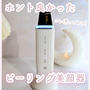 この価格で本当にいいの？ANLANのピーリング美顔器