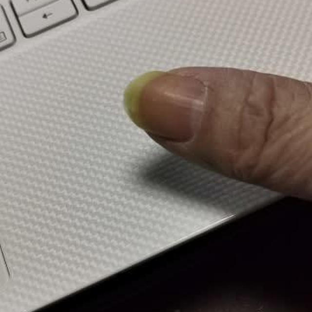 気が付いたら黄色いかも…