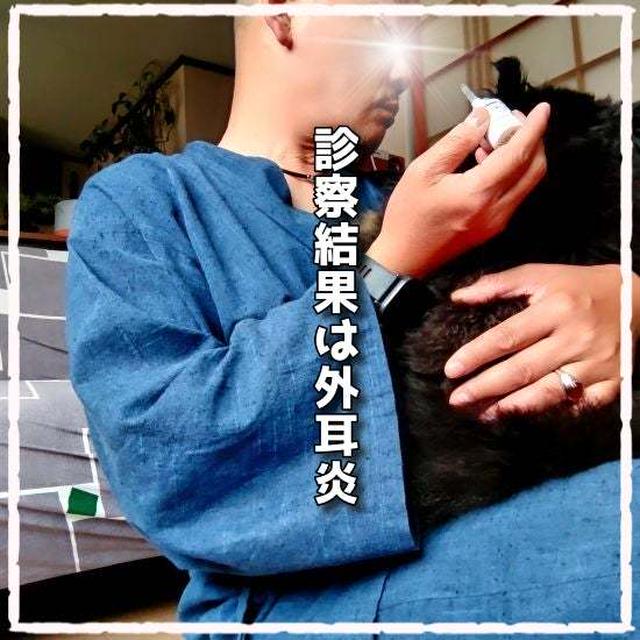診察結果は外耳炎