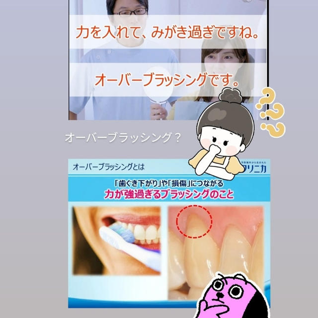 音のなる歯ブラシ