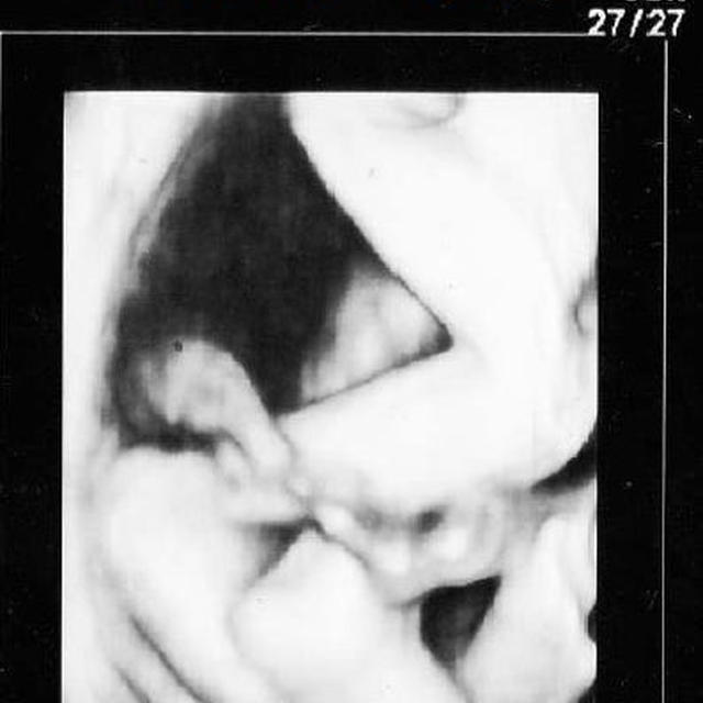 23w4d　初めての４Dエコー！！