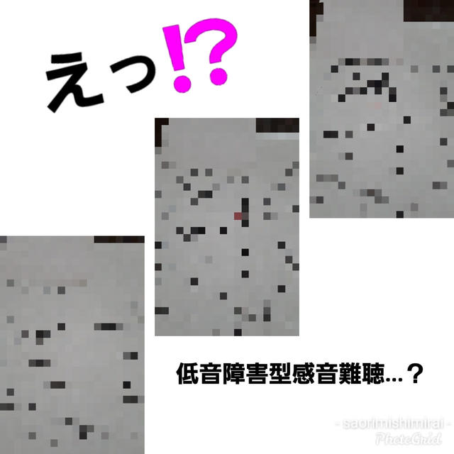 [実体験] 低音障害型感音難聴になりました