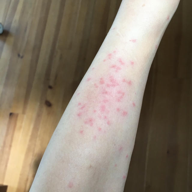蚊じゃなかった。。