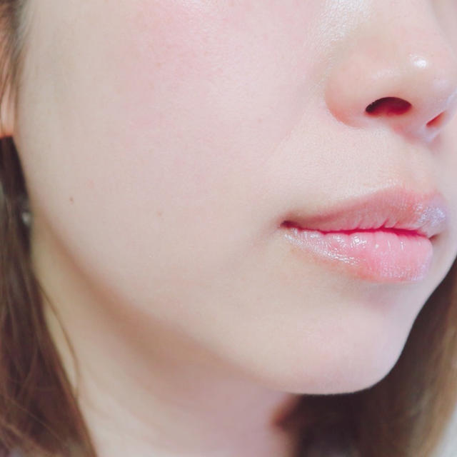 その肌トラブル、「隠れマグマ肌」？