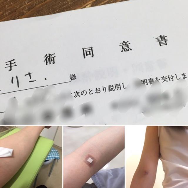 説明と同意書