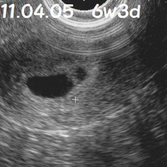 6w3d　心拍確認