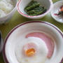13w6d 入院生活8日目(採血で…(￣0￣)/&病院食記録)