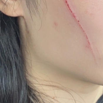 皆様もくれぐれもお気を付けください。