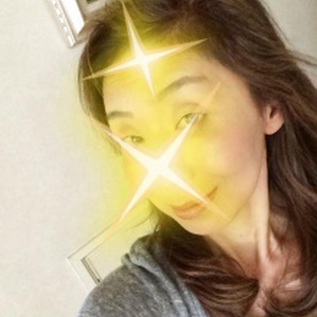 おでこのしわが(￣◇￣;)