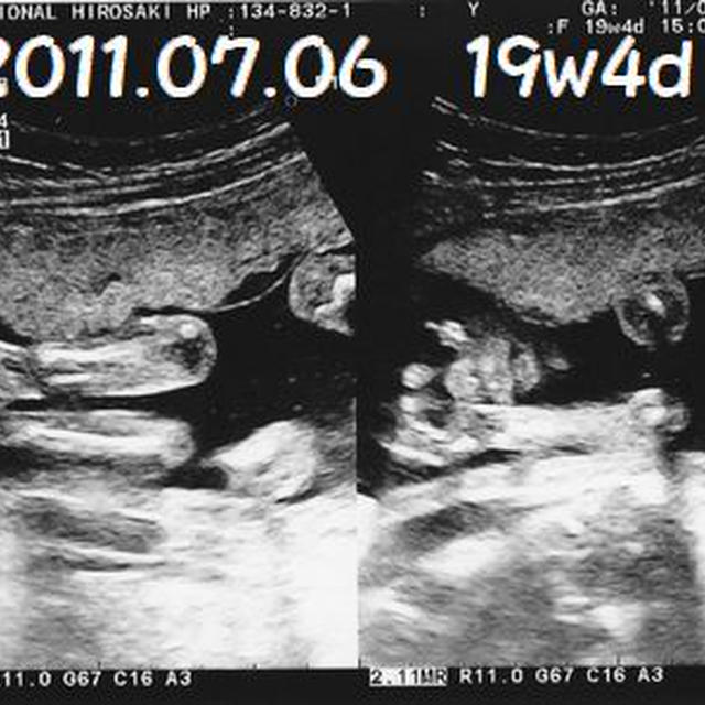19w4d　　弘前での最後の検診!!＆甥っ子の性別予想