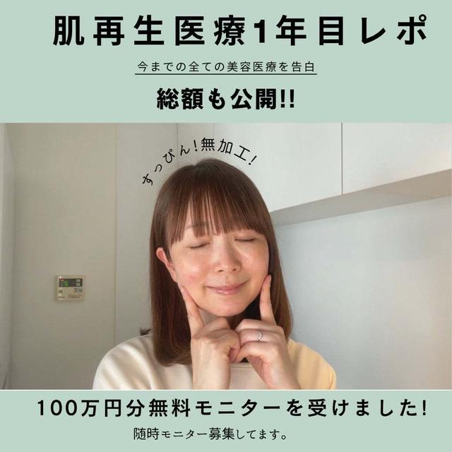 【肌再生医療から1年】100万円分の施術を無料モニターで体験！驚きのビフォーアフター＆美容医療の