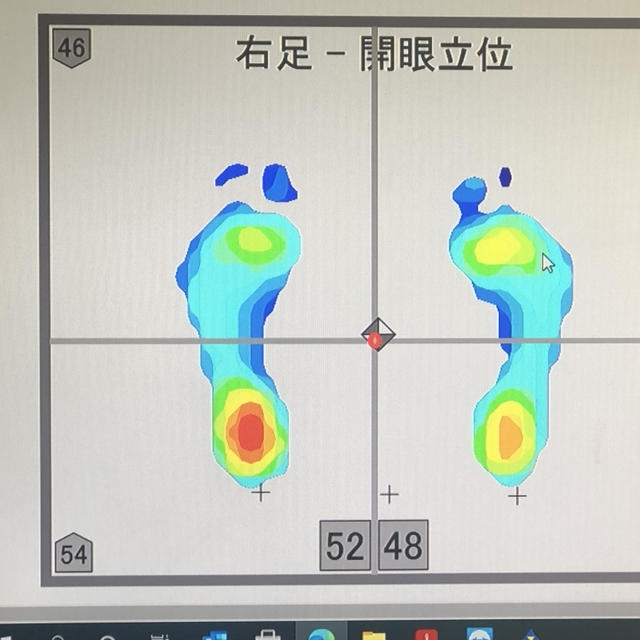 インソールの効果確認