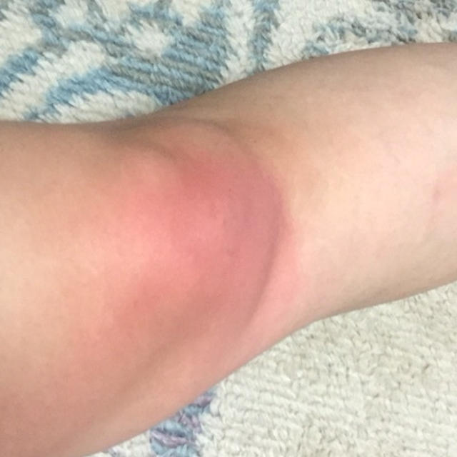 お風呂場で転んだー