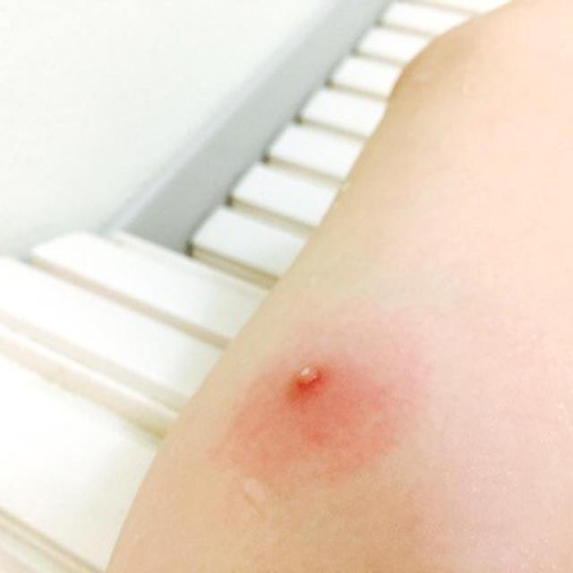 次は皮膚かよ！