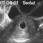 5w6d　エンジェルリング♪