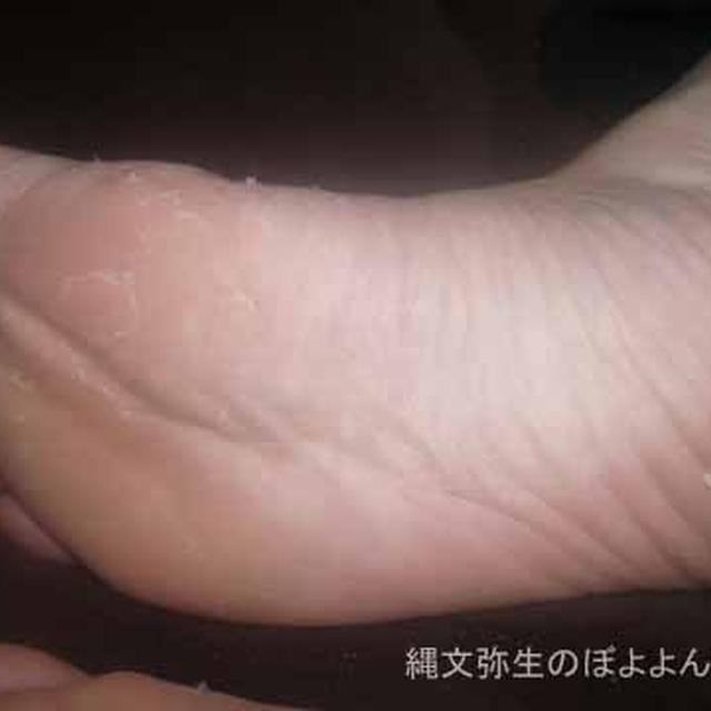 ベビーフット　ぬくぬくもこもこ大作戦　３日目　５日目　６日目