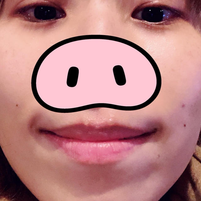 くちびる事件。
