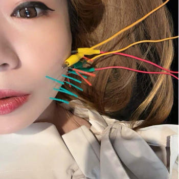 切開リフトだけじゃダメだった！顔のたるみの原因と美容鍼+EMS+小顔矯正へ