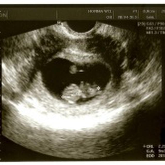 8w6d