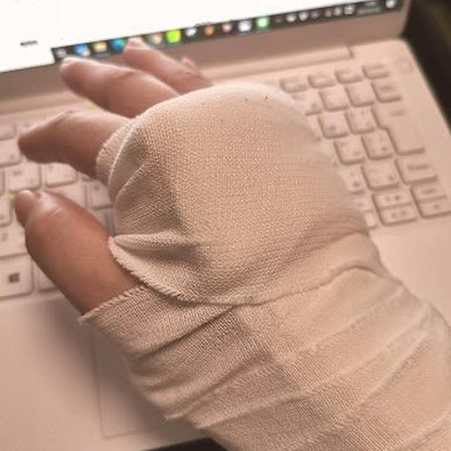 転ぶと折れるお年頃…(;_;)