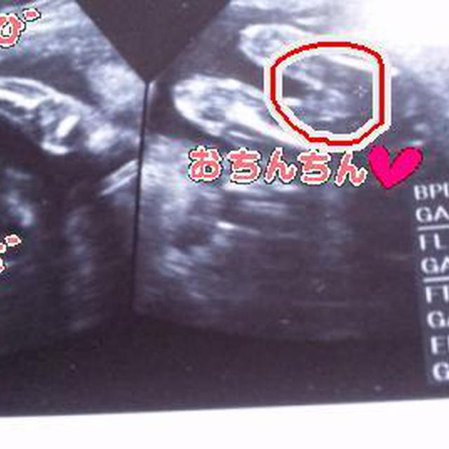 ２２ｗ５ｄ　*エコー外来デビュー*