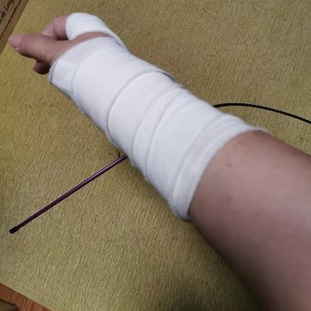 ギブスは短くなり、病院は夏休みに入る